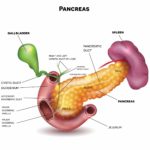 pancreatic-cancer-iStock-653533198