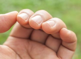 Погледнете ги прстите, доколку го видите ова на прст ви се заканува смртоносна болест на белите дробови!