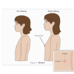 GirlBook2-breast-v3