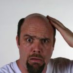 cure-for-hair-loss-hair-loss-genetic