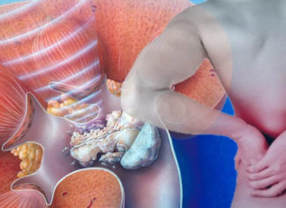 Од камења во бубрезите може да ве спасат само три литри вода дневно