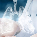 lung-transplant-g