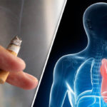 Smoking-cigarettes-lung-cancer-807552
