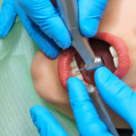 Dentist treats girl’s teeth.