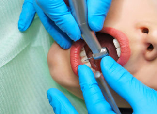 Знаете ли од што може да ве болат забите, а да не се работи за кариес?