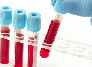 Тест на крвта открива рак на дојка пет години пред појава на симптомите