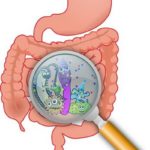 colon_infection