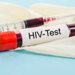hiv-test
