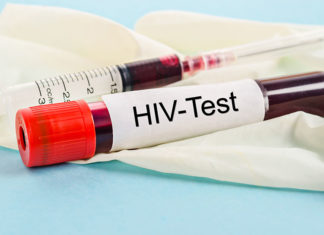 Се појави нов сој на ХИВ после 19 години, кој може да биде голем предизвик
