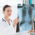 Doctor examining Xray report