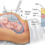 STRUCEN 2