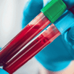 hemophilia 6