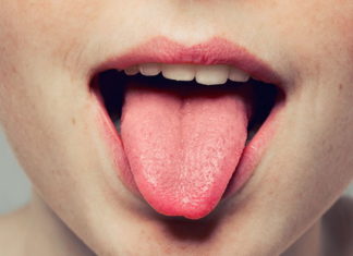 Имате испакнатини и јазолчиња на јазикот? Тоа е проблем, појдете на лекар!