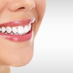 teeth-whitening-1