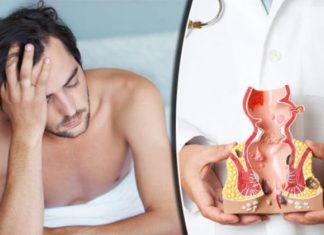 Не срамете се да појдете на лекар: Ова се најчести симптоми на рак на анусот