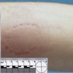 FORENZIKA 3