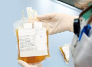 Лекување на КОВИД-19 со крвна плазма во земјава: Кој и како може да донира