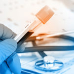 gloved-hand-blood-tube-stethoscope