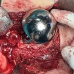thumbnail_IMG_6928