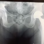 thumbnail_IMG_7026
