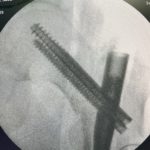 thumbnail_IMG_7883