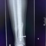 thumbnail_IMG_7975