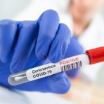 Coronavirus infected blood sample tube