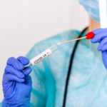 Lab technician holding swab collection kit,Coronavirus COVID-19 specimen collecting equipment,DNA nasal and oral swabbing for PCR polymerase chain reaction laboratory testing procedure and shipping