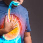 Gastroesophageal,Reflux,Disease,:,Gerd