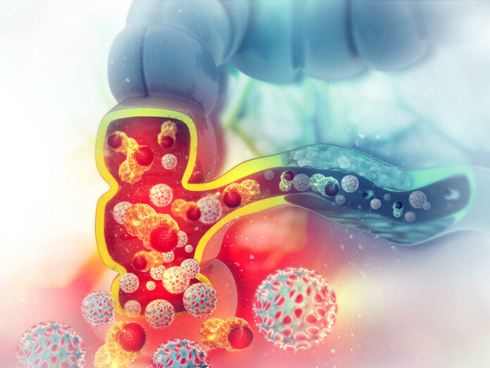 Colon cancer. Cancer attacking cell. Colon disease concept