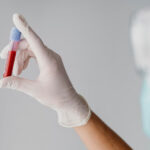 Hemophilia