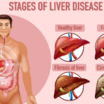 Liver 2
