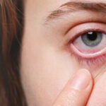 blood eyes 1
