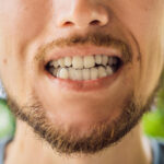 Bruxism