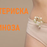 БАКТЕРИСКА ВАГИНОЗА