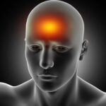 pineal gland tumor