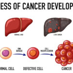 pancreas 356