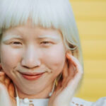 albino