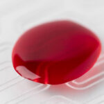 blood in urine