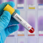 listeria 1