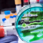 listeria 12
