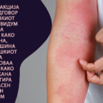 reakcija-alergija