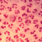 Neisseria gonorrhoeae