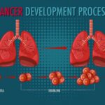 Cancer Development Process infographic