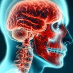 blue-red-x-ray-depicts-medical-anatomy-head-pain (1)