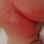 diaper-rash-in-newborns-e1588673656618 1