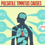 Pulsatile-Tinnitus-Causes