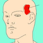 Head_with_temple