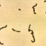 Streptococci