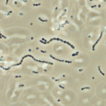 Streptococcus_iniae